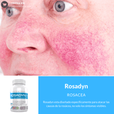 Rosadyn Rosacea - 60 Cápsulas - Puro Estado Fisico